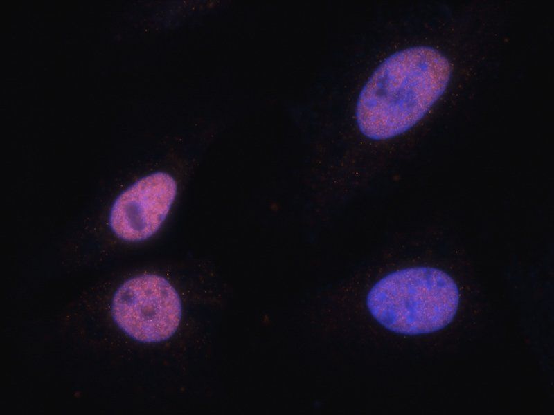 NRSF/REST Rabbit Polyclonal Antibody