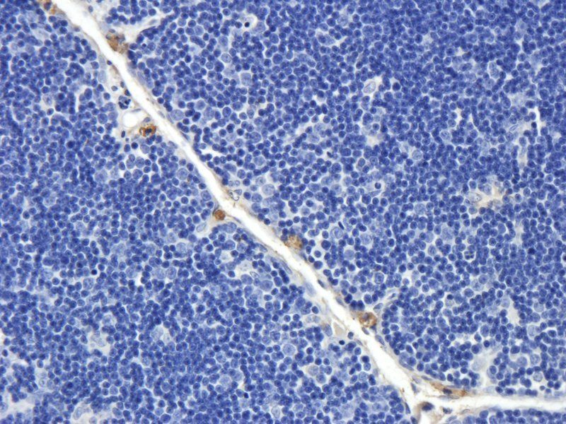 NRSF/REST Rabbit Polyclonal Antibody