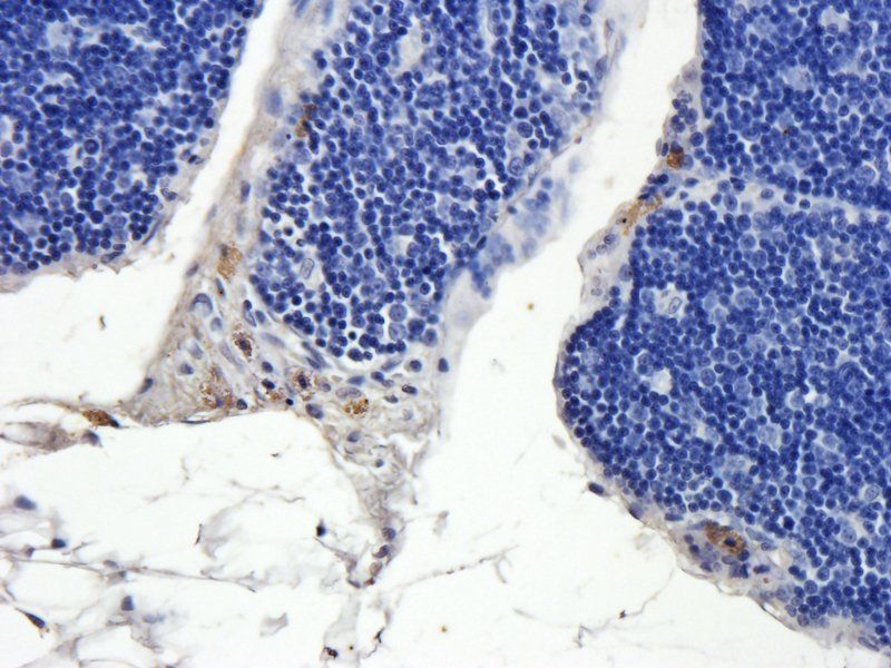 NRSF/REST Rabbit Polyclonal Antibody