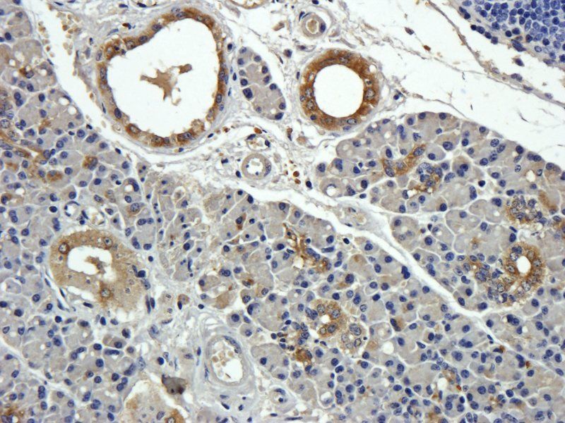NRSF/REST Rabbit Polyclonal Antibody