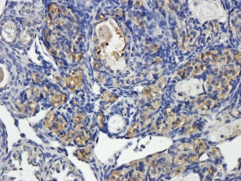 NRSF/REST Rabbit Polyclonal Antibody