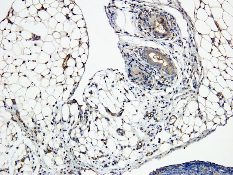NRSF REST Protein Rabbit Polyclonal Antibody