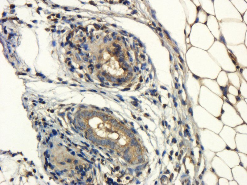 NRSF REST Protein Rabbit Polyclonal Antibody