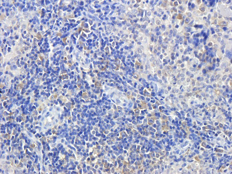 NRSF REST Protein Rabbit Polyclonal Antibody