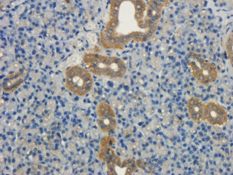 NRSF REST Protein Rabbit Polyclonal Antibody