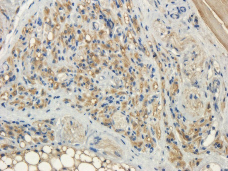 NRSF REST Protein Rabbit Polyclonal Antibody