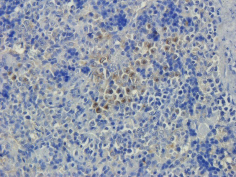 NRSF REST Protein Rabbit Polyclonal Antibody