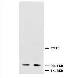 NSE/ENO2 Rabbit Polyclonal Antibody