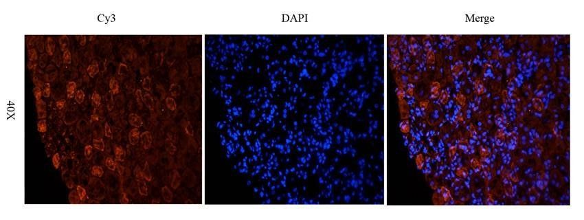 NTCP Rabbit Polyclonal Antibody