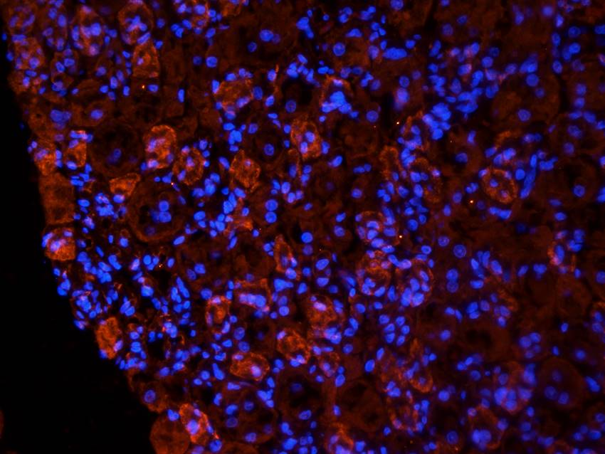 NTCP Rabbit Polyclonal Antibody