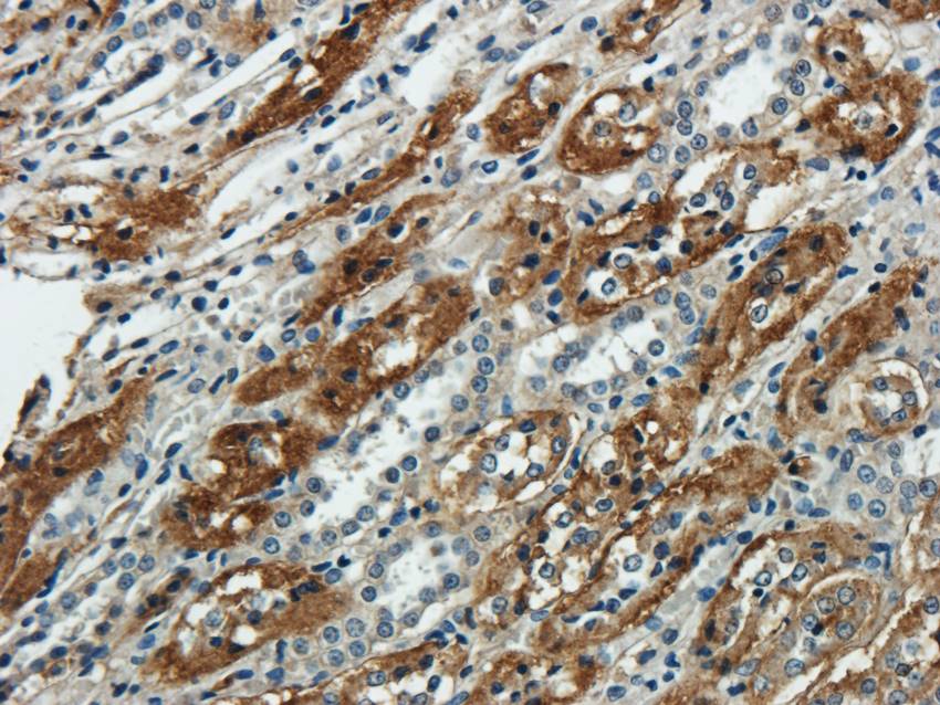 NTCP Rabbit Polyclonal Antibody