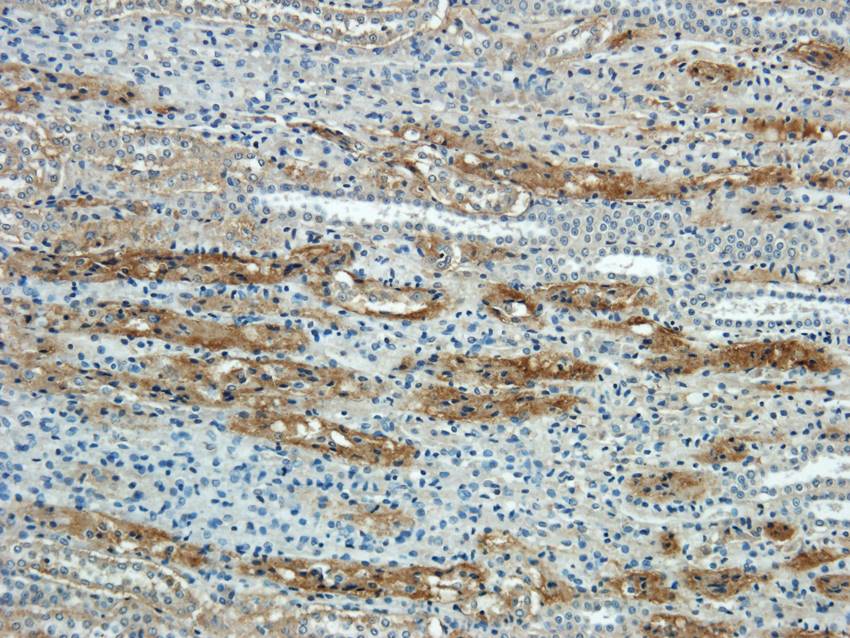 NTCP Rabbit Polyclonal Antibody