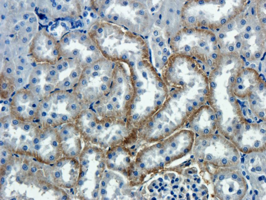 NTCP Rabbit Polyclonal Antibody
