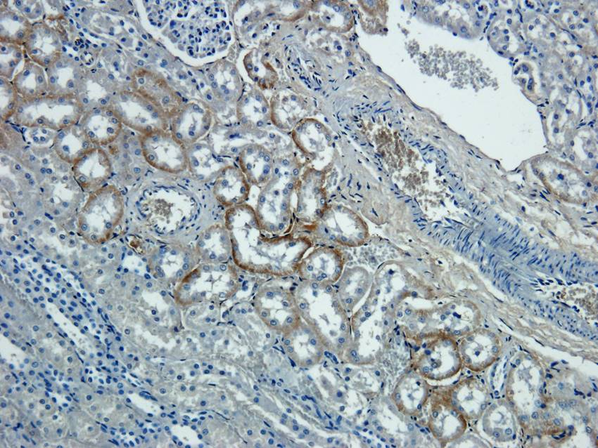 NTCP Rabbit Polyclonal Antibody
