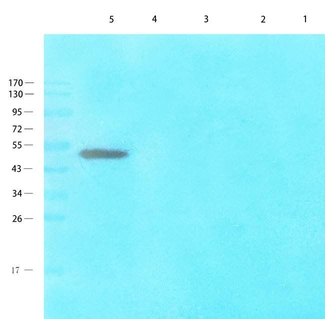 NTCP Rabbit Polyclonal Antibody