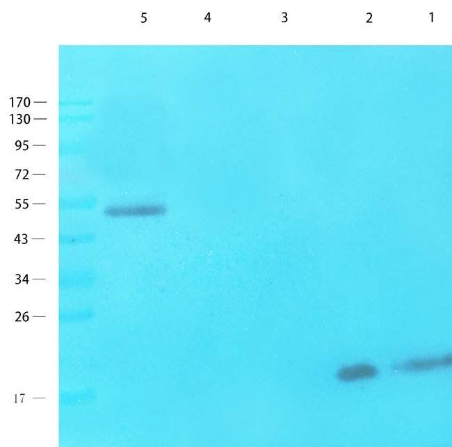 NTCP Rabbit Polyclonal Antibody