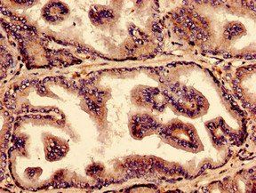 NUP210 Antibody