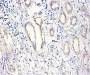 NUP210 Antibody