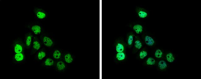 NUF2 Rabbit Polyclonal Antibody