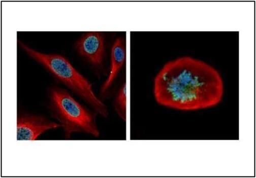 NUF2 Rabbit Polyclonal Antibody
