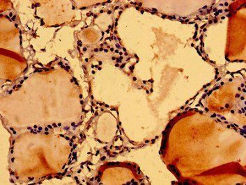 NUMA1 Antibody