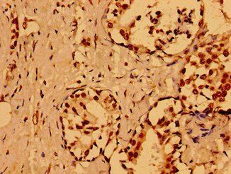 NUMA1 Antibody
