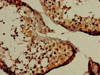 NUP107 Antibody