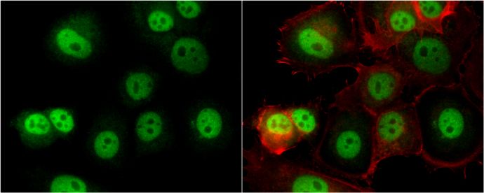 O-GlcNAc transferase Rabbit Polyclonal Antibody