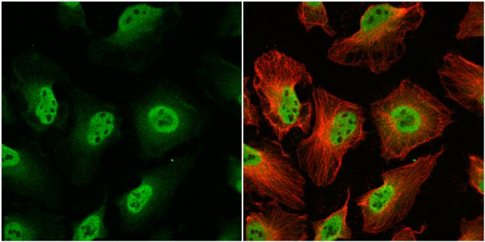 O-GlcNAc transferase Rabbit Polyclonal Antibody