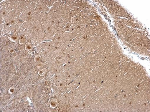 O-GlcNAc transferase Rabbit Polyclonal Antibody
