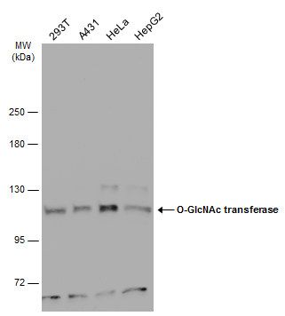 O-GlcNAc transferase Rabbit Polyclonal Antibody