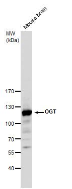 O-GlcNAc transferase Rabbit Polyclonal Antibody