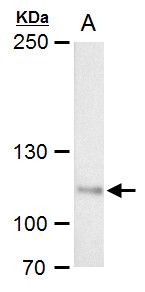 O-GlcNAc transferase Rabbit Polyclonal Antibody