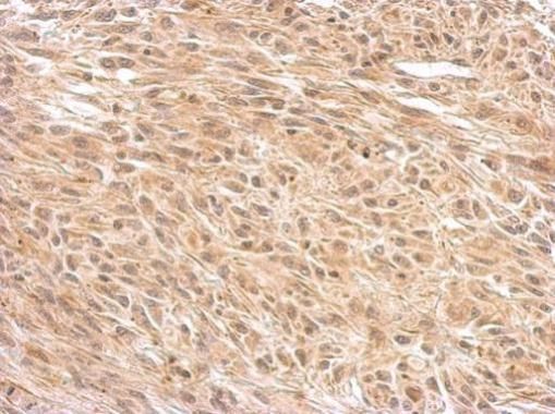 O-GlcNAc transferase Rabbit Polyclonal Antibody