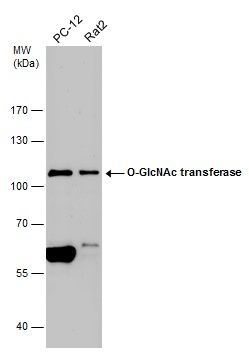 O-GlcNAc transferase Rabbit Polyclonal Antibody