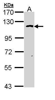 O-GlcNAc transferase Rabbit Polyclonal Antibody