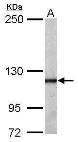O-GlcNAc transferase Rabbit Polyclonal Antibody