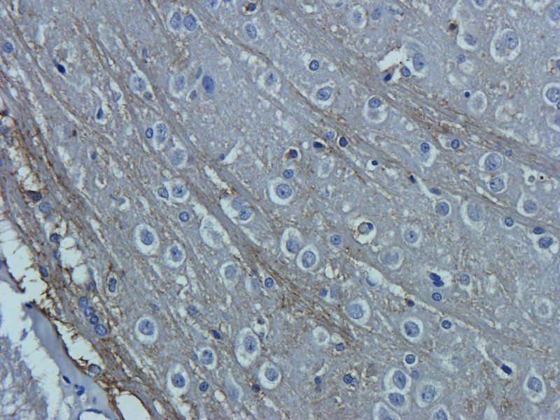 OAT3 Rabbit Polyclonal Antibody