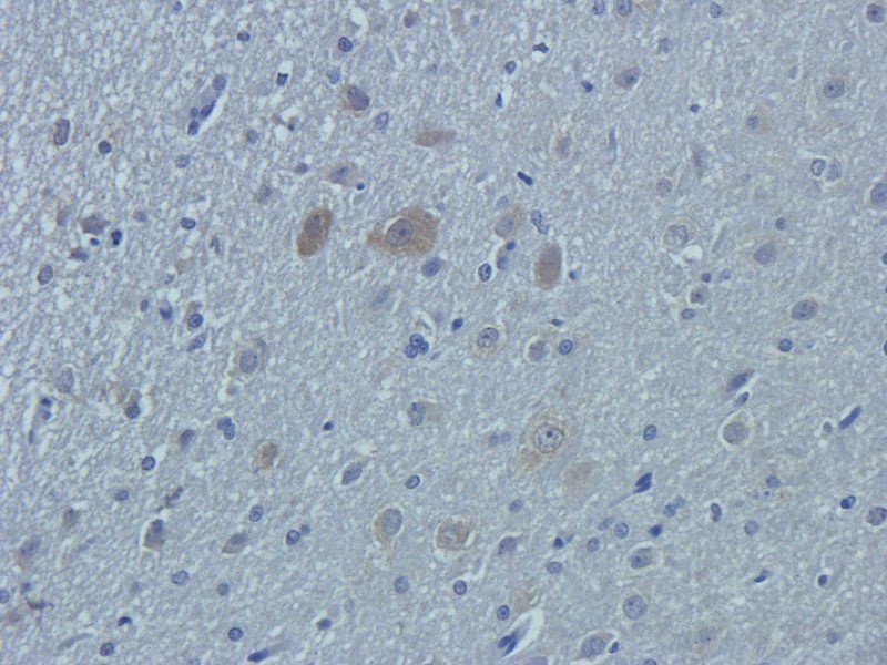 OAT3 Rabbit Polyclonal Antibody