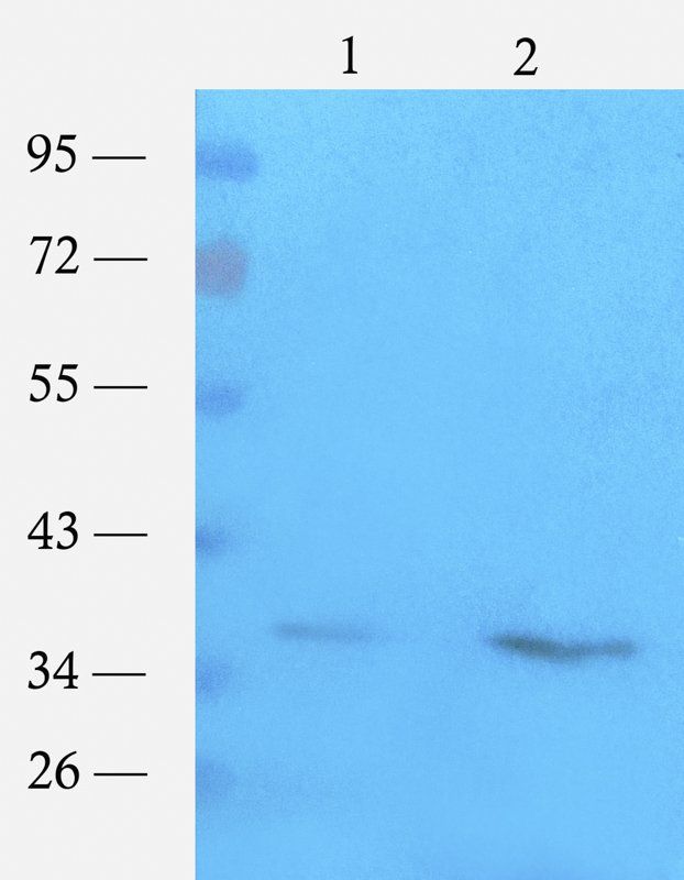 ompC Rabbit Polyclonal Antibody
