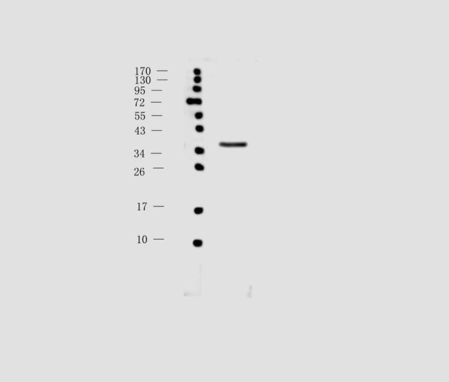 ompF Rabbit Polyclonal Antibody
