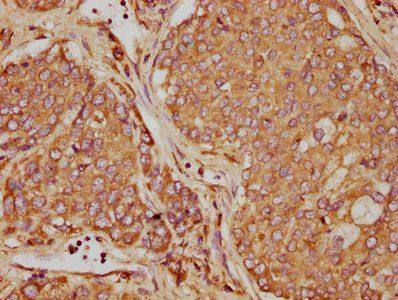 OSM Antibody