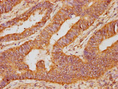 OSM Antibody