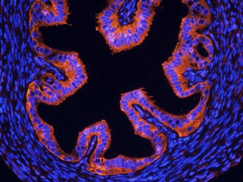 OPG Rabbit Polyclonal Antibody