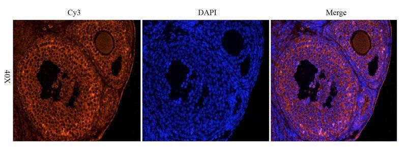 OPG Rabbit Polyclonal Antibody