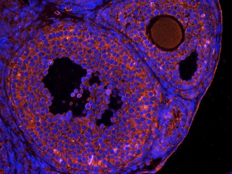 OPG Rabbit Polyclonal Antibody