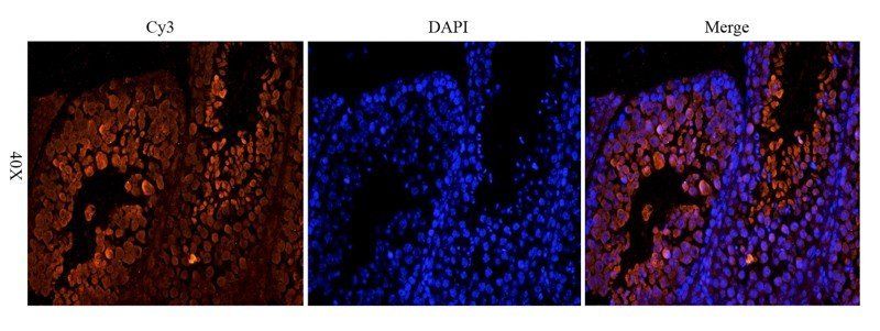 OPG Rabbit Polyclonal Antibody