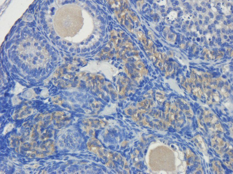 OPG Rabbit Polyclonal Antibody