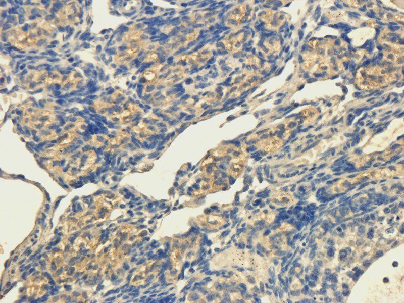 OPG Rabbit Polyclonal Antibody