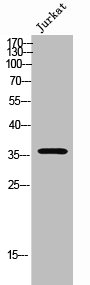 OR52E2 Antibody
